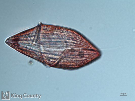 Photo of Gyrodinium spp.